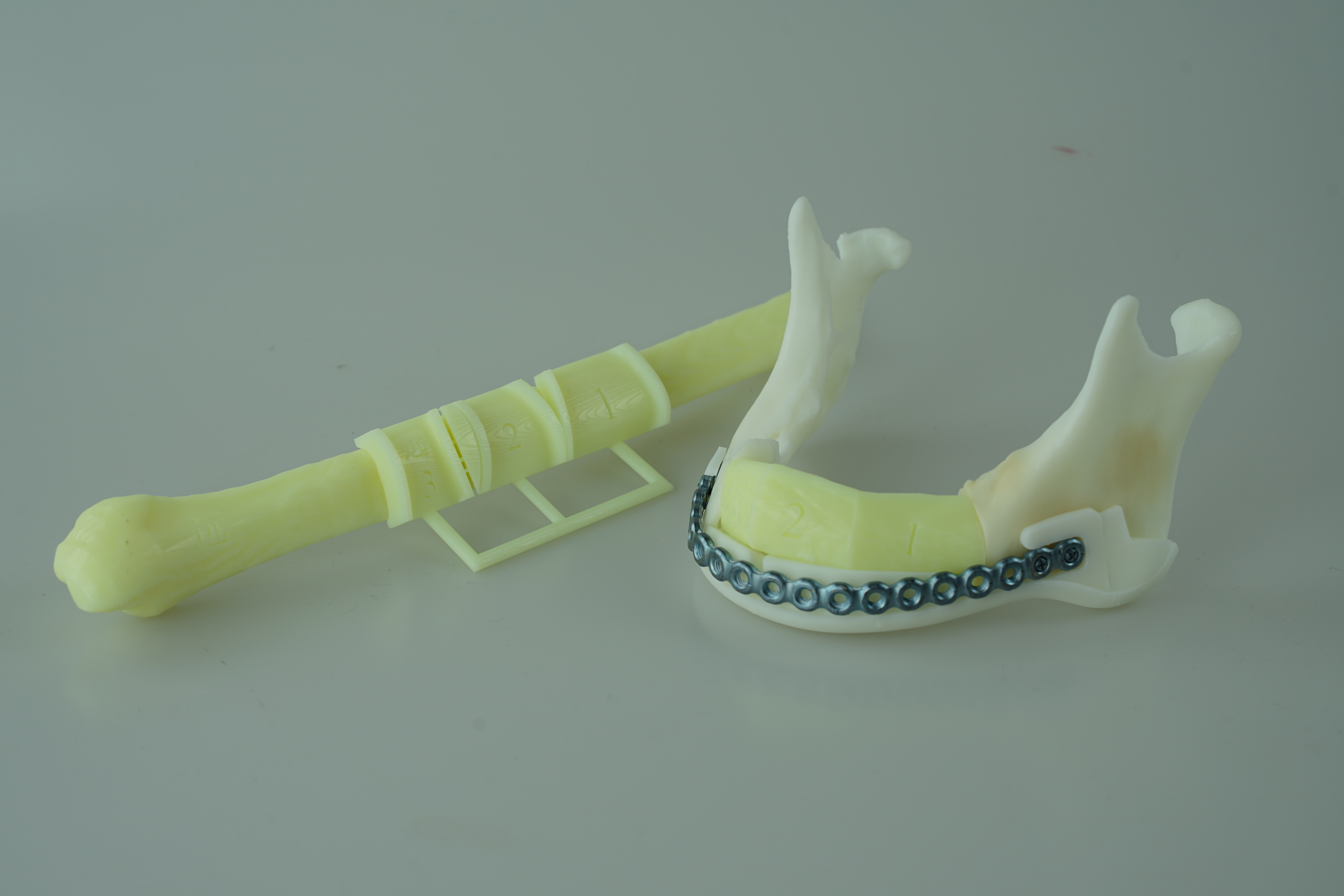 三维数字化应用3d打印在口腔手术中的应用